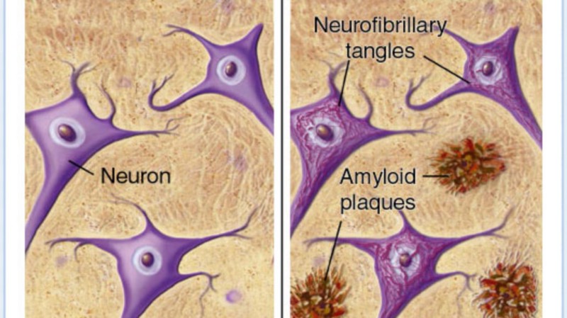 Picture of neurons